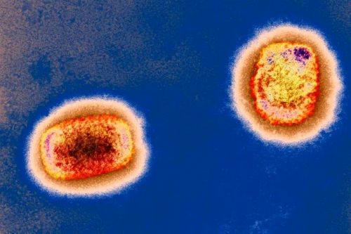 猴痘病例已输入亚洲，警惕猴痘病毒大流行！